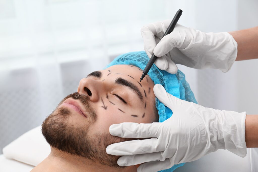 blefaroplastia-hombre-1-1024x683