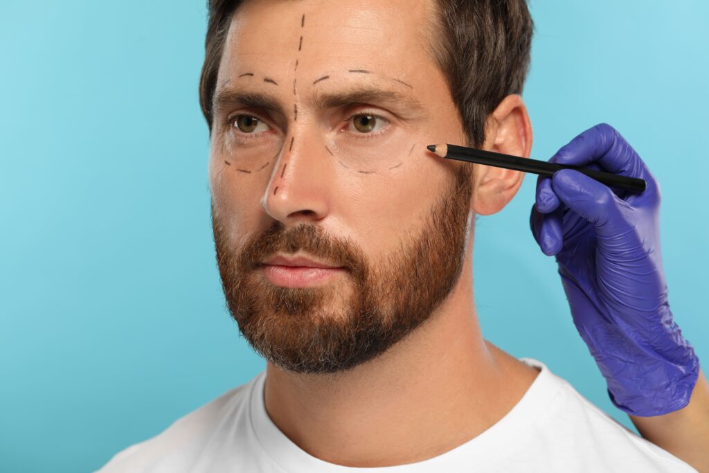 blefaroplastia-hombre-2-1024x683