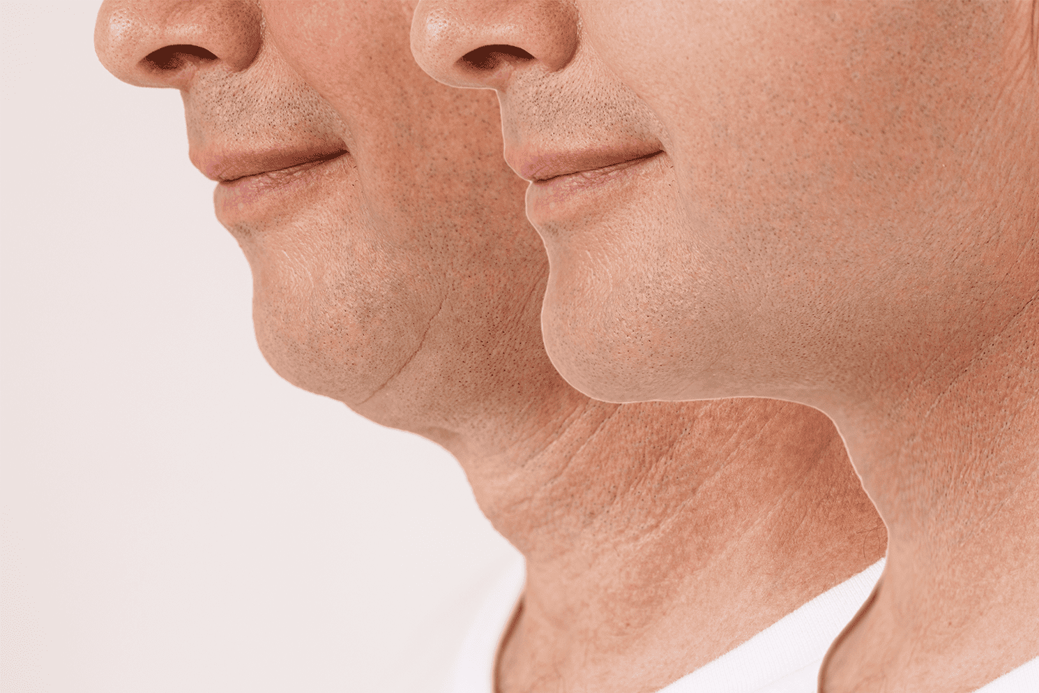 hombre-cuello
