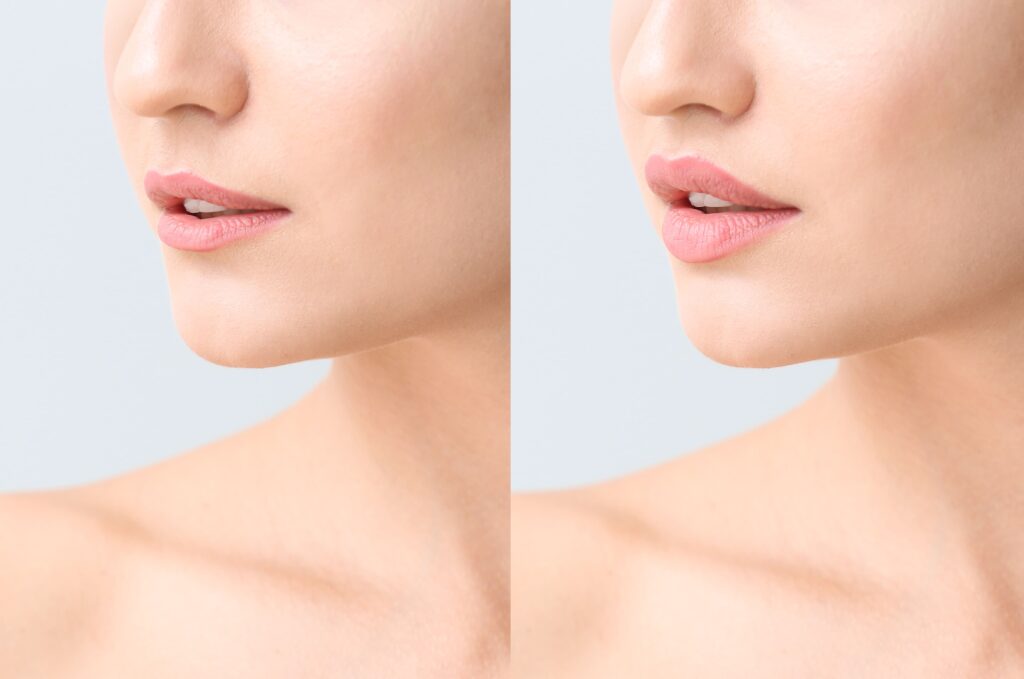 lip-fit-5-1024x679
