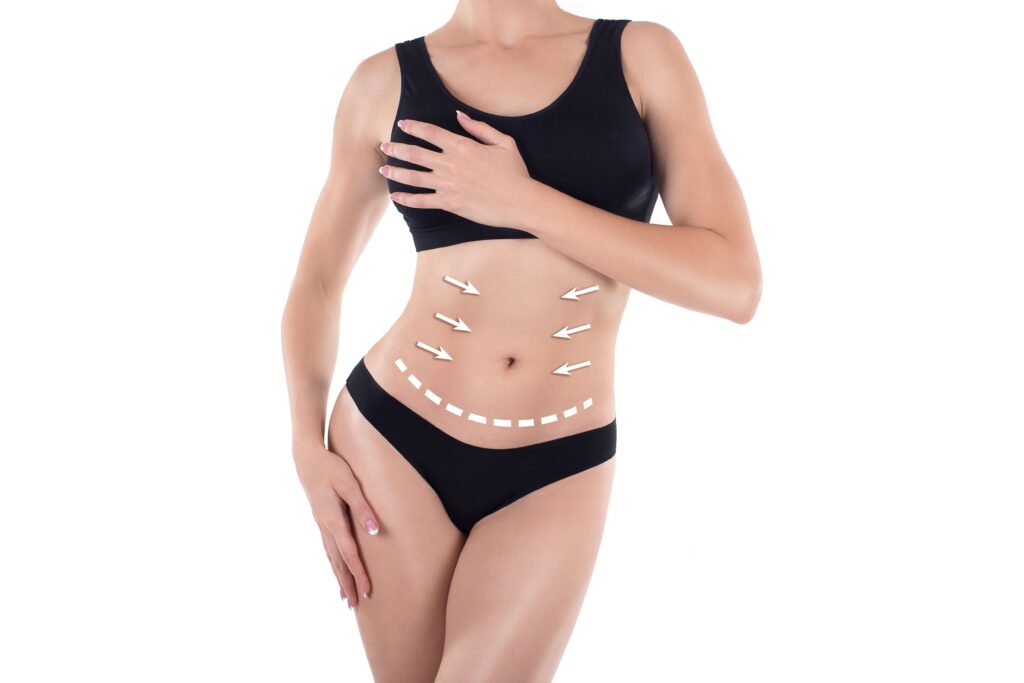 liposuccion-abdomen-1-1024x683
