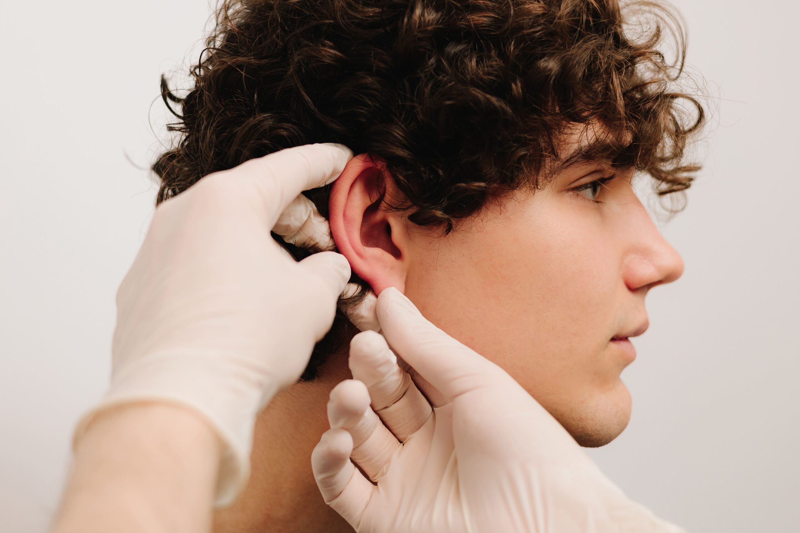 otoplastia-hombre-2-scaled