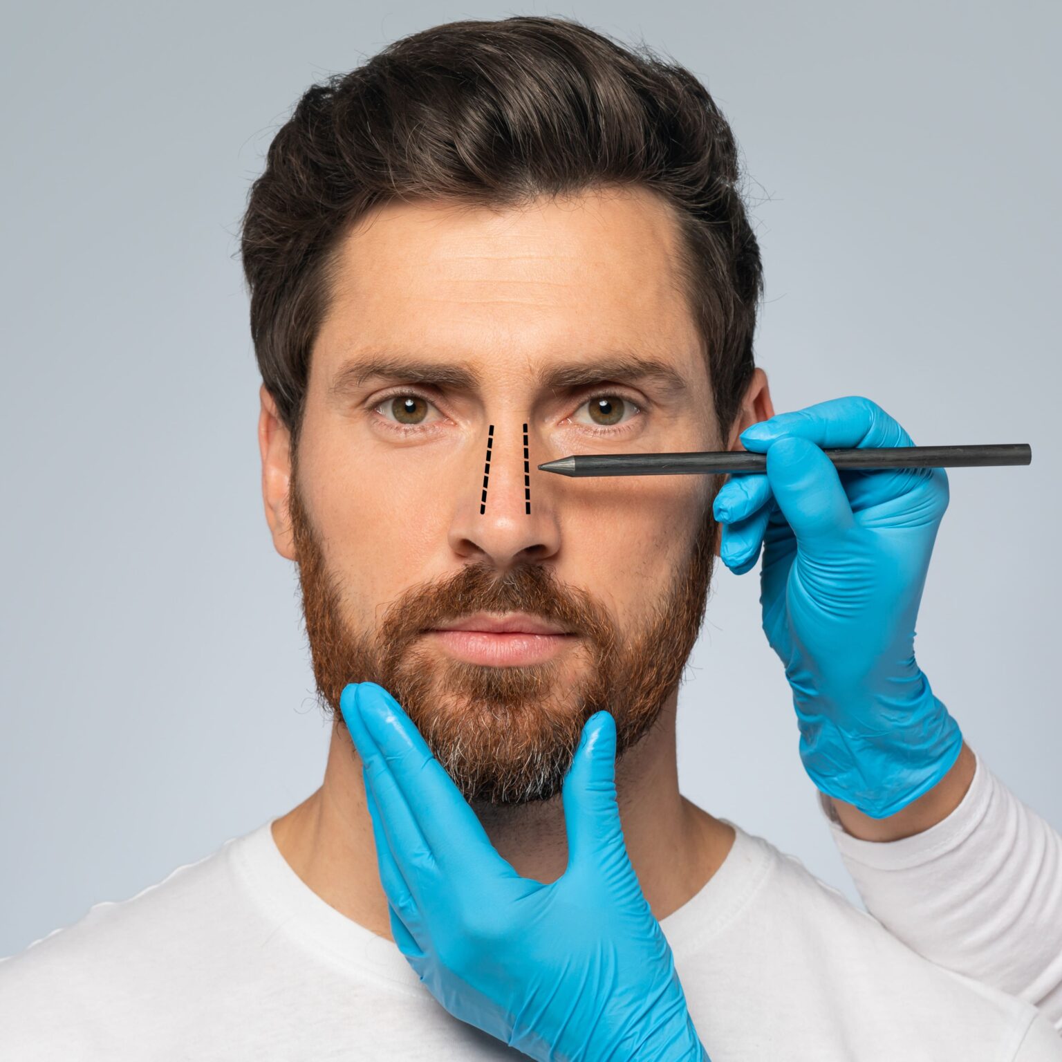 rinoplastia-hombre-1-1536x1536